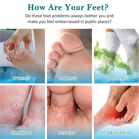 بخاخ تولنافتات 1% للرياضيين مضاد للفطريات ومزيل الروائح الكريهة للقدم والأحذية - يساعد على تخفيف الحكة والحروق والتقشير ورائحة القدم والأحذية الكريهة، بخاخ مزيل العرق سريع الجفاف وغير دهني - 3.4 أونصة سائلة in Kuwait