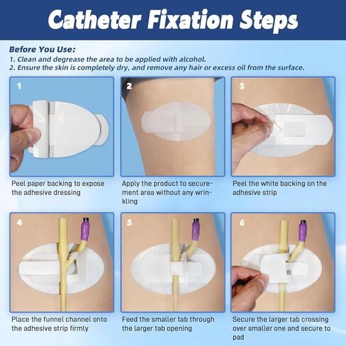 جهاز تثبيت القسطرة (40 قطعة)، لوازم قسطرة فولي، حامل حقيبة الساق مع خطاف وحلقة ذاتية اللصق كبيرة جدًا، مثبت أنبوب بولي قابل للتنفس لأنابيب تغذية PEG/G/J in Kuwait