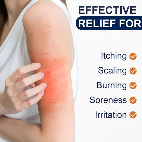 Antifungal Cream for Jock Itch, Athletes Foot & Ringworm - 2% Miconazole Nitrate Cream for Humans Skin Fungus, Relieves Itching, Burning, Cracking and Scaling (3.5 Ounce) in Saudi Arabia