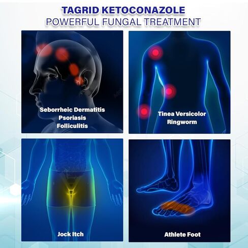 TAGRID Antifungal Cream for Ringworm & Tinea Versicolor, Maximum Strength Antifungal Care for Men & Women, Daily Use for Body Skin, Fast Itch Relief, 100g in Kuwait