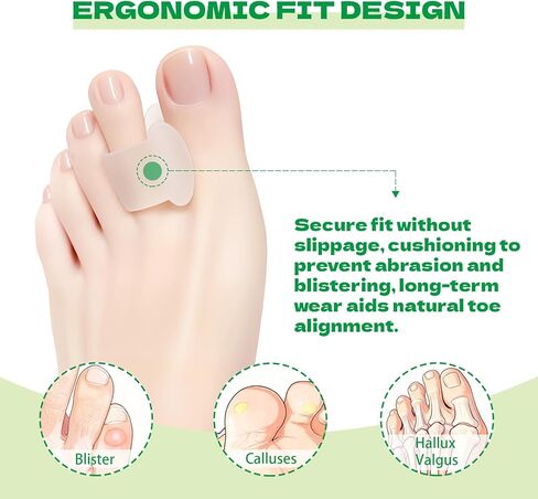 فواصل أصابع القدم للنساء والرجال، 12 قطعة من فواصل جل سميكة لأصابع القدم، مصحح ورم، لأصابع القدم المتداخلة/الأورام/محاذاة إصبع القدم الكبيرة/فاصل ومصحح (أبيض) in Kuwait