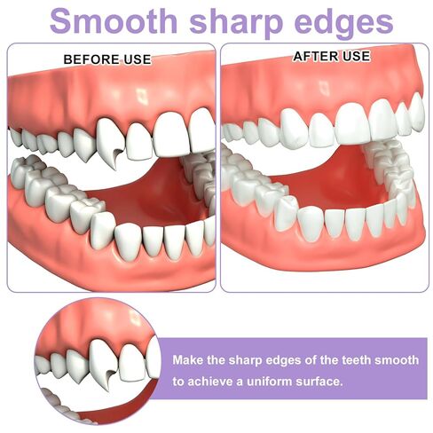 120pcs Dental Polishing Strips, 4 Colors Teeth Sanding Grinding Filer Tool Tooth Polishing Strips Teeth Polish Sandpaper Abrasive File Kit Floss Polisher for Oral Health Cleaning Gloss Contouring in Kuwait