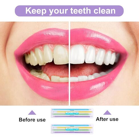 120pcs Dental Polishing Strips, 4 Colors Teeth Sanding Grinding Filer Tool Tooth Polishing Strips Teeth Polish Sandpaper Abrasive File Kit Floss Polisher for Oral Health Cleaning Gloss Contouring in Kuwait