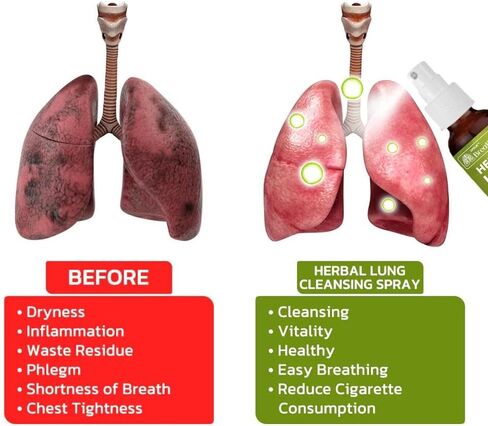 Lung Cleansing Spray Lung Detox Vapor Pen – Herbal Diffuser for Respiratory Support, 30ml Detox Mist To Clear Airways, Reduce Inflammation – Portable, Travel-friendly for Daily Care in Saudi Arabia