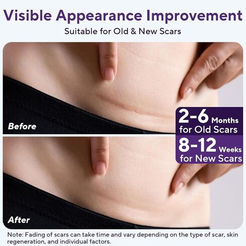 Silicone Scar Sheets, Silicone Scar Tape (1.6"x 60" Roll-1.5m), Advanced Scars Strips for Surgical, C-Section, Tummy Tuck, Burn, Hypertrophic, Keloid Bump Removal Treatment, Reusable in Kuwait