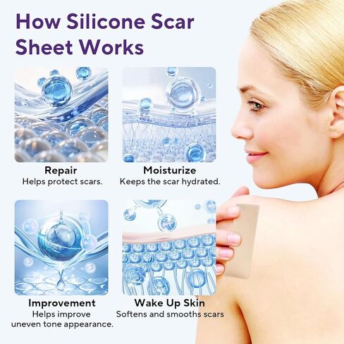 Silicone Scar Sheets, Silicone Scar Tape (1.6"x 60" Roll-1.5m), Advanced Scars Strips for Surgical, C-Section, Tummy Tuck, Burn, Hypertrophic, Keloid Bump Removal Treatment, Reusable in Kuwait