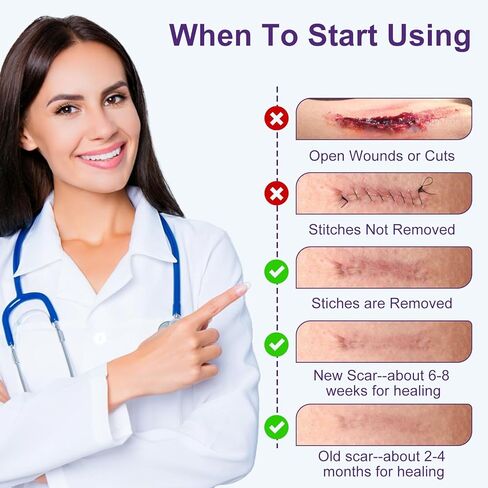 Silicone Scar Sheets, Silicone Scar Tape (1.6"x 60" Roll-1.5m), Advanced Scars Strips for Surgical, C-Section, Tummy Tuck, Burn, Hypertrophic, Keloid Bump Removal Treatment, Reusable in Kuwait