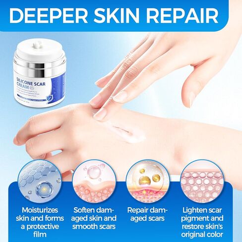 Scar Cream, Silicone Scar Gel, Professional Scar Removal Cream for Surgical Scars, Stretch Marks, Keloids, Burns, Acne, Old and New Scars, 1.76 oz (50ml) in Kuwait