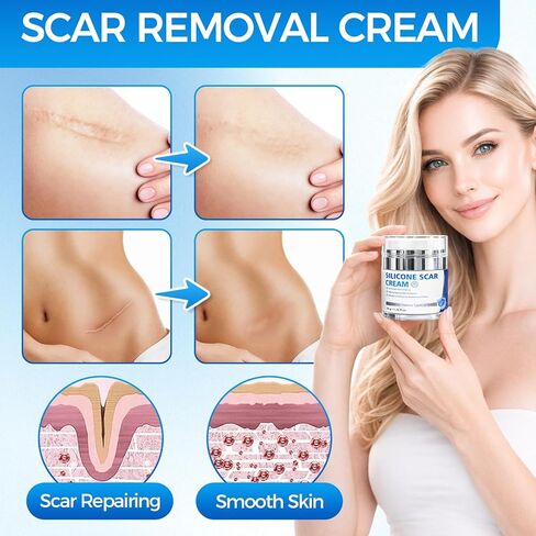 Scar Cream, Silicone Scar Gel, Professional Scar Removal Cream for Surgical Scars, Stretch Marks, Keloids, Burns, Acne, Old and New Scars, 1.76 oz (50ml) in Kuwait