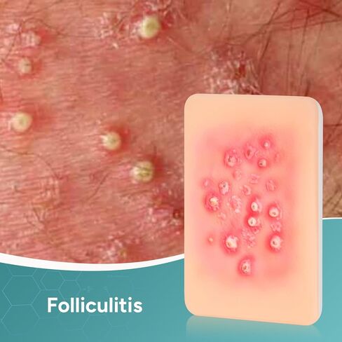 Wound Packing Trainer, Bacterial Infected Wound Model, Palm Sized Wound Simulation Models for Medical Education, Wound Care Demonstrations Tool, 4PCS in Kuwait