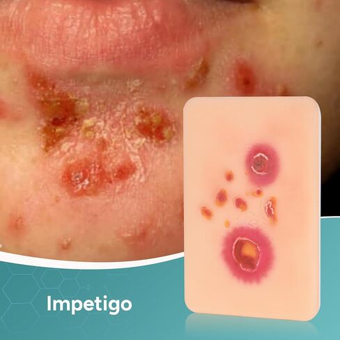 Wound Packing Trainer, Bacterial Infected Wound Model, Palm Sized Wound Simulation Models for Medical Education, Wound Care Demonstrations Tool, 4PCS in Kuwait