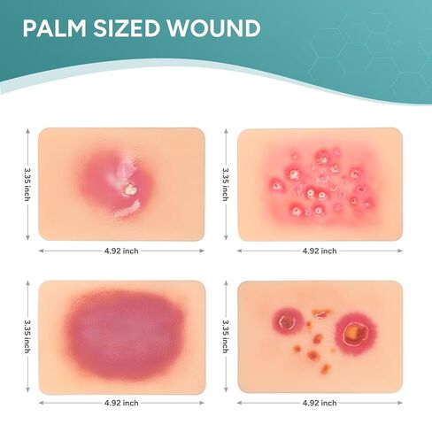 Wound Packing Trainer, Bacterial Infected Wound Model, Palm Sized Wound Simulation Models for Medical Education, Wound Care Demonstrations Tool, 4PCS in Kuwait