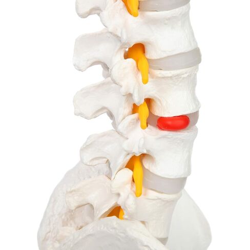 Axis Scientific Full Size Ultra Flexible Spine Model with Removable Femur Heads - Comprehensive Spine Anatomy Model with Nerves, Includes Full Color Product Manual in Kuwait