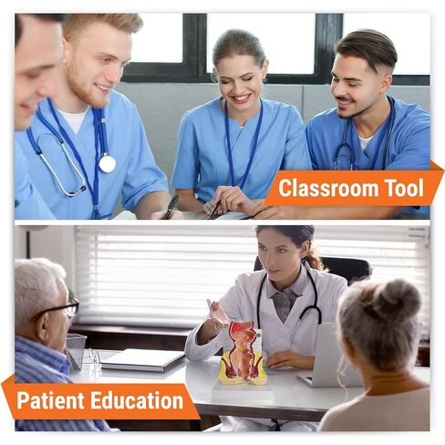 GPI Anatomicals - Human Rectum Model with Common Pathologies, Replica for Anatomy and Physiology Education, Anatomy Model for Doctor's Offices and Classrooms, Medical Learning Resources in Kuwait