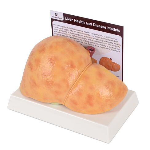 Silicone Alcoholic Fatty Liver Model, Pathological Liver Replica for Medical Training & Liver Disease Education in Kuwait