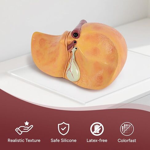 Silicone Alcoholic Fatty Liver Model, Pathological Liver Replica for Medical Training & Liver Disease Education in Kuwait