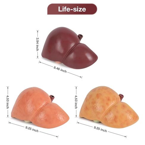 Silicone Alcoholic Fatty Liver Model, Pathological Liver Replica for Medical Training & Liver Disease Education in Kuwait