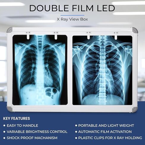 صندوق عرض الأشعة السينية LED، فيلم مزدوج مع مستشعر تنشيط الفيلم التلقائي، 28 × 17 بوصة، تحكم متغير في السطوع، أبيض، عبوة من قطعتين in Kuwait