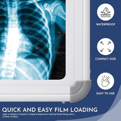 صندوق عرض الأشعة السينية LED، فيلم مزدوج مع مستشعر تنشيط الفيلم التلقائي، 28 × 17 بوصة، تحكم متغير في السطوع، أبيض، عبوة من قطعتين in Kuwait