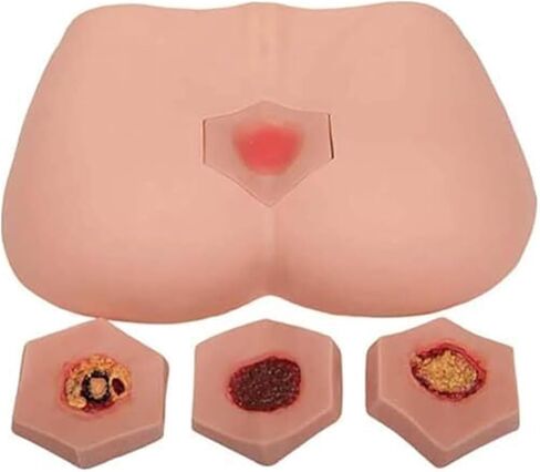 EDSORE Wound Care, Four Stages of Pressure Ulcers, Simulated Nursing Model, Medical Training Practice in Saudi Arabia