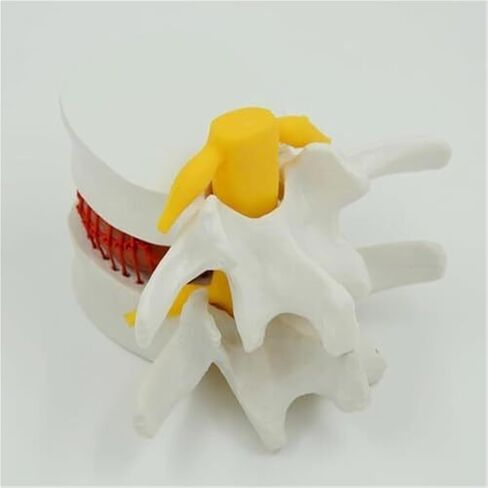 التشريح البشري لفتق القرص القطني، نماذج العضلات والأعضاء in Kuwait