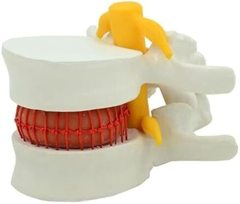التشريح البشري لفتق القرص القطني، نماذج العضلات والأعضاء in Kuwait