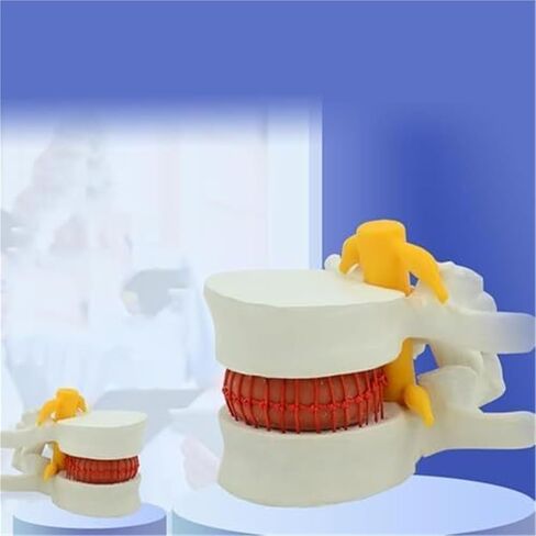 التشريح البشري لفتق القرص القطني، نماذج العضلات والأعضاء in Kuwait