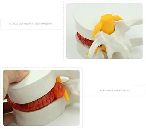 التشريح البشري لفتق القرص القطني، نماذج العضلات والأعضاء in Kuwait