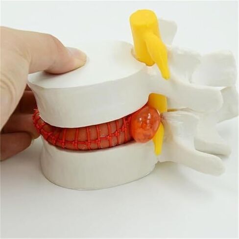 التشريح البشري لفتق القرص القطني، نماذج العضلات والأعضاء in Kuwait