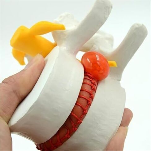 التشريح البشري لفتق القرص القطني، نماذج العضلات والأعضاء in Kuwait