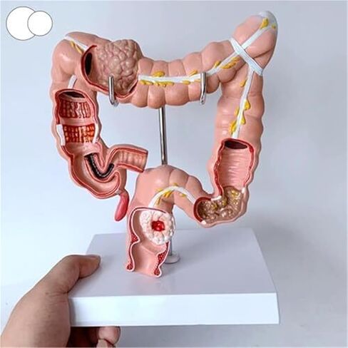 Human Colon Anatomical Model, Physiology Education Replica in Saudi Arabia
