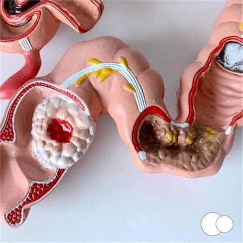 Human Colon Anatomical Model, Physiology Education Replica in Saudi Arabia