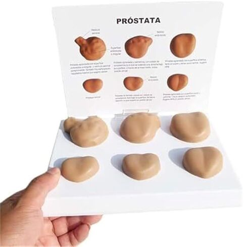 Medical Learning and Teaching of Male Prostate and Comparative Pathological Prostate Anatomy Model in Saudi Arabia