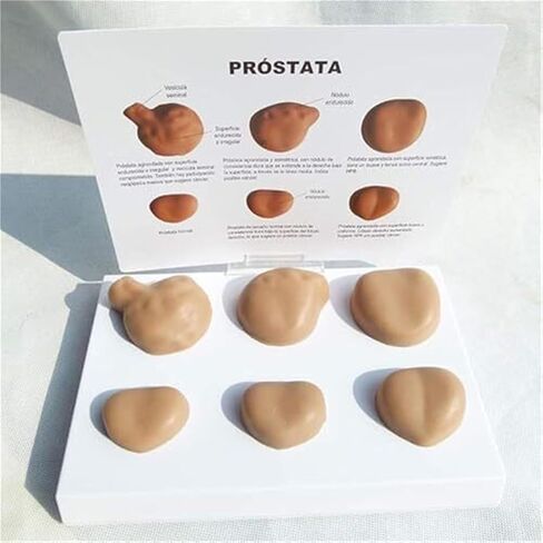 Medical Learning and Teaching of Male Prostate and Comparative Pathological Prostate Anatomy Model in Saudi Arabia