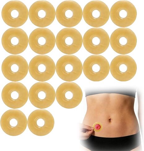 20 حزمة من حلقات حاجز الفغرة، أختام فغر الغروانية المائية، مستلزمات فغرة موسع الجلد المرن بسمك 2 مم، حلقات تمديد الجلد المانعة للتسرب لأكياس فغر القولون فغر اللفائفي in Kuwait