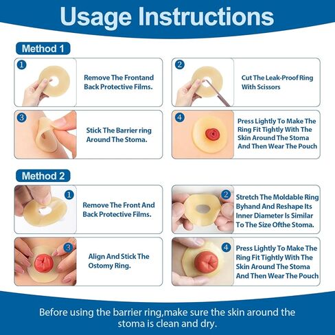 20 حزمة من حلقات حاجز الفغرة، أختام فغر الغروانية المائية، مستلزمات فغرة موسع الجلد المرن بسمك 2 مم، حلقات تمديد الجلد المانعة للتسرب لأكياس فغر القولون فغر اللفائفي in Kuwait