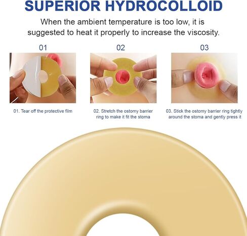 6 عبوات من حلقات حاجز الفغرة بسُمك 2 مم وشريط غرواني مائي قابل للتشكيل وأختام متماسكة لفغر القولون وفغر اللفائفي وأكياس فغر البول in Kuwait