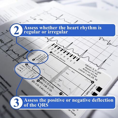 20 قطعة مسطرة ECG ذات 7 خطوات، مسطرة فرجار EKG شفافة لتفسير ECG/EKG، بطاقة EKG بلاستيكية، أداة قياس بطاقة الجيب المحمولة لإيقاع ECG/EKG، تتبع خطة 7 خطوات in Kuwait