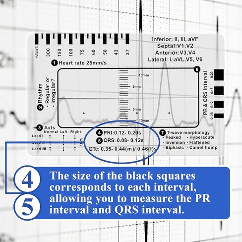 20 قطعة مسطرة ECG ذات 7 خطوات، مسطرة فرجار EKG شفافة لتفسير ECG/EKG، بطاقة EKG بلاستيكية، أداة قياس بطاقة الجيب المحمولة لإيقاع ECG/EKG، تتبع خطة 7 خطوات in Kuwait