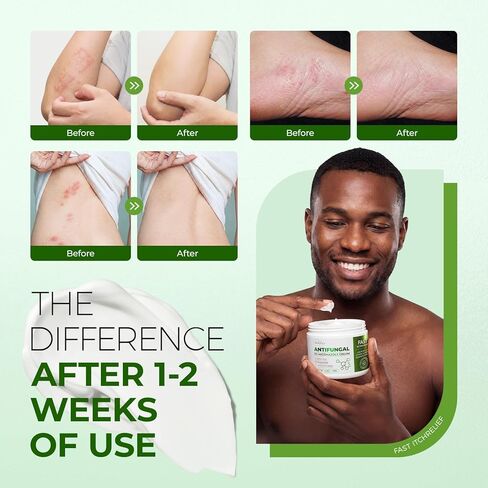 كريم مضاد للفطريات من إنليفاي لقدم الرياضيين: علاج مضاد للفطريات مع 2% نترات ميكونازول لحكة جوك السعفة - سريع الامتصاص وغير دهني لعشاق الصالة الرياضية للاستخدام اليومي (3.4 أونصة) in Kuwait