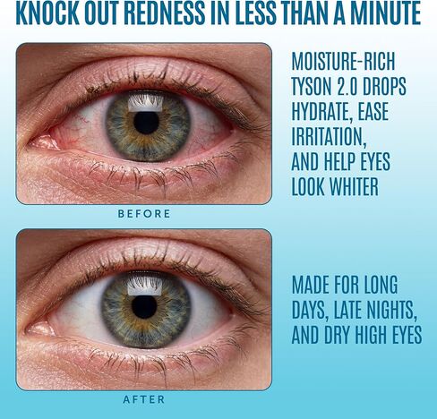 TYSON 2.0 Mike Red Eye Drops, Brighter Whiter Eyes in 1 Minute, Max Strength Redness Reliever & Lubricant for Dry Irritated Red Eyes, 0.5 Fl Oz (15 mL) in Kuwait