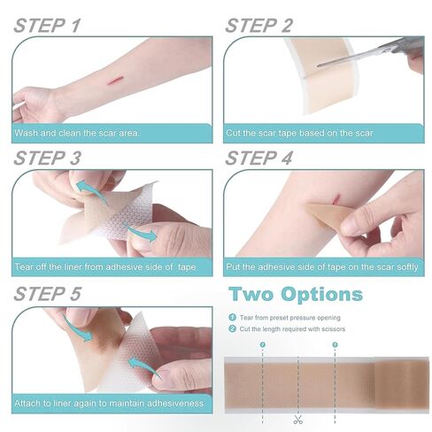 Silicone Scar Tape/Sheets for Surgical Scars, (1.6" x 59") Silicone Scar Removal Strips for Surgical, C-Section, Tummy Tuck, Keloid Scars Keloid Bump Removal (4cm x 1.5M) in Kuwait
