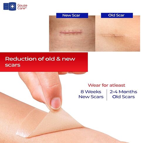 GauzeCare Silicone Scar Tape – 1.6"x120" Roll – Medical-Grade, Reusable, Professional Silicone Scar Tape for surgical scars, C-Section, Burns, Keloid, and Acne Scars in Kuwait