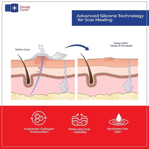 GauzeCare Silicone Scar Tape – 1.6"x120" Roll – Medical-Grade, Reusable, Professional Silicone Scar Tape for surgical scars, C-Section, Burns, Keloid, and Acne Scars in Kuwait