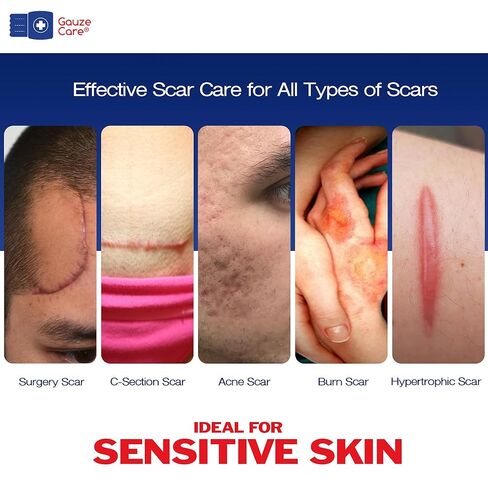 GauzeCare Silicone Scar Tape – 1.6"x120" Roll – Medical-Grade, Reusable, Professional Silicone Scar Tape for surgical scars, C-Section, Burns, Keloid, and Acne Scars in Kuwait
