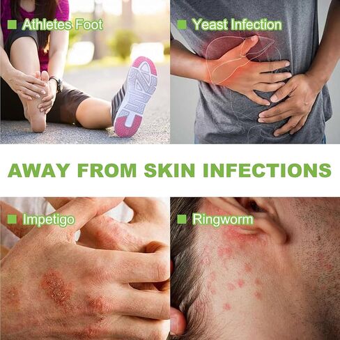 قالب صابون طبي مضاد للفطريات، علاج عدوى الخميرة للرياضيين، حكة جوك القدم للرجال، قالب صابون للجسم بزيت شجرة الشاي مع زيت شجرة الشاي الطبيعي، وزيت الأوكالبتوس وزيت اللافندر، قطعتان in Kuwait