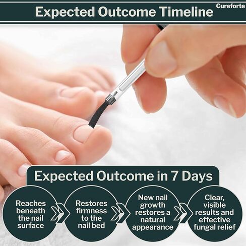 مصل مضاد للفطريات لعلاج فطريات القدم والأظافر بأقصى قوة مع تولنافتات 1% - محلول سريع الامتصاص لتخفيف الجلد والفطريات لدى الرياضيين - تركيبة غير دهنية (30 مل) in Kuwait