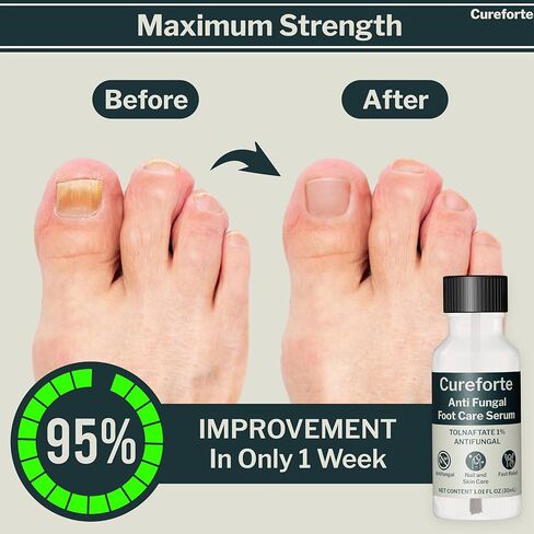 مصل مضاد للفطريات لعلاج فطريات القدم والأظافر بأقصى قوة مع تولنافتات 1% - محلول سريع الامتصاص لتخفيف الجلد والفطريات لدى الرياضيين - تركيبة غير دهنية (30 مل) in Kuwait