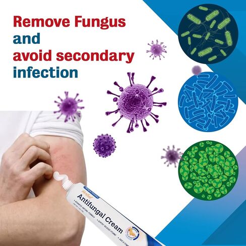 كريم مضاد للفطريات لالتهاب الجلد الدهني والتهاب الجريبات: مناسب لفروة الرأس والجسم، ويدعم التهاب الجلد حول الفم، وحب الشباب الفطري الخلفي، والقوباء الحلقية، وقدم الرياضي وحكة اللعب، 1 أونصة in Kuwait
