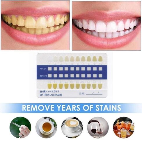 PVC 20pcs Teeth Shade Guide Set, Frosted Long Strip Tooth Contrast Cards for Professional and Home Oral Care in Saudi Arabia